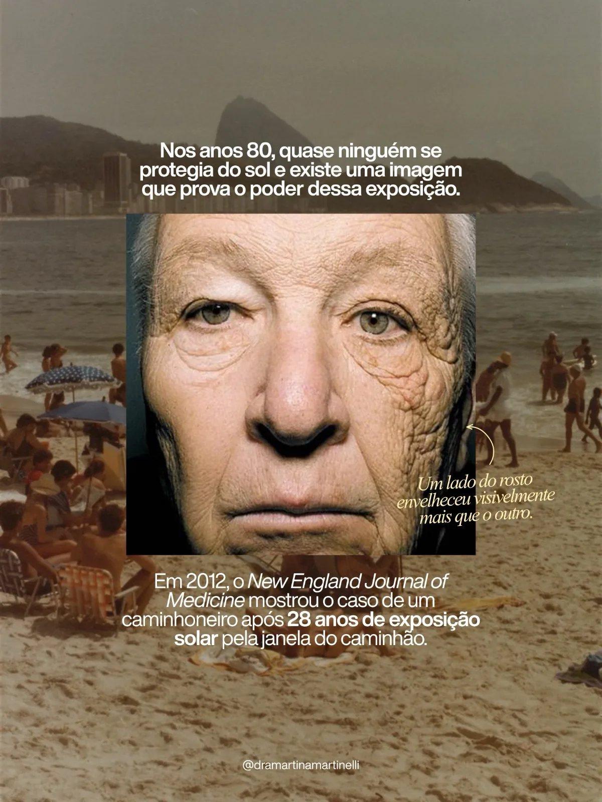 Pele marcada pelo sol — recorte da testa e da linha do cabelo, sem identificar a pessoa